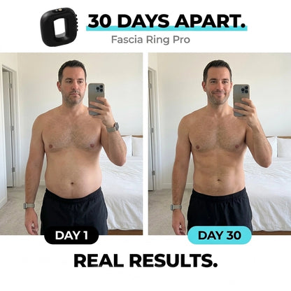 Fascia Ring Pro™