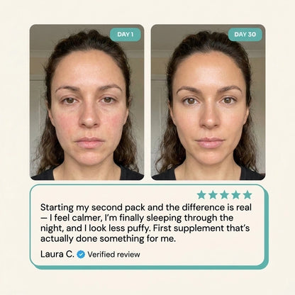 Nulevel™ Cortisol Balance