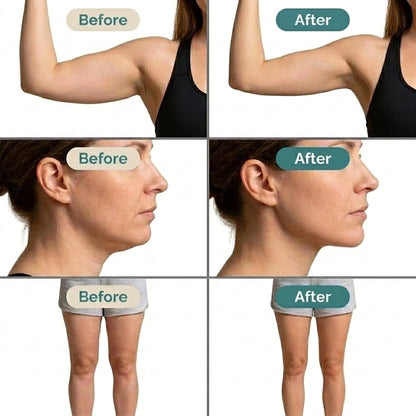 Lymphatic Drainage