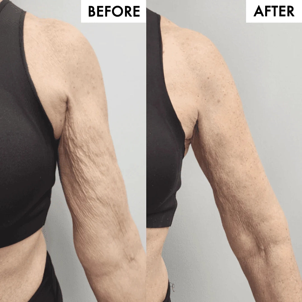 FitSlim 3D CurveTone™ Arm Sleeves