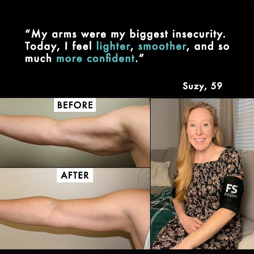 FitSlim 3D CurveTone™ Arm Sleeves